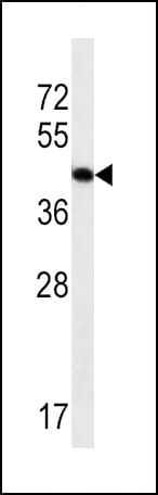 ACTA1 / Skeletal Muscle Actin Antibody