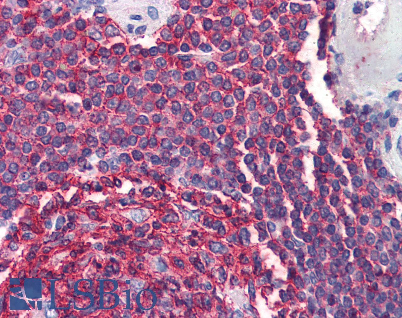 IHC-plus™ CD20 Antibody (aa284-297)