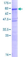 Human SMAP1 Protein (Recombinant GST)