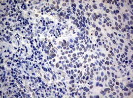 RASGRP3 / GRP3 Antibody (clone OTI2G7)