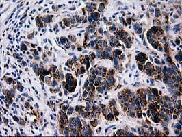 MAC-2-BP / LGALS3BP Antibody (clone 5.00E+03, Carrier-free)