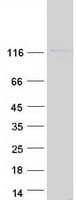 Human EIF3B Protein (Recombinant Myc-DDK (Flag))