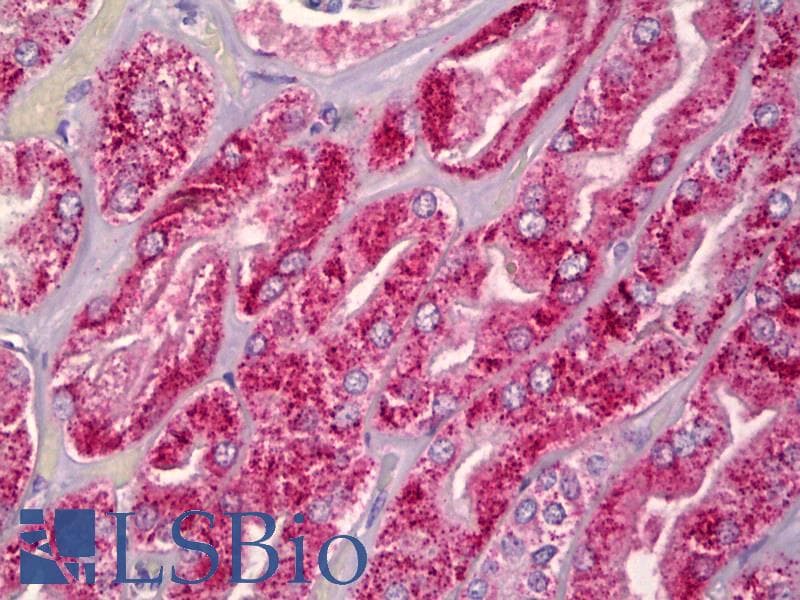 IHC-plus™ CPN1 Antibody (Internal, clone EPR6229)