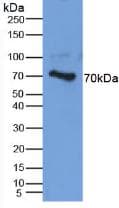ACAN / Aggrecan Antibody (aa34-147)