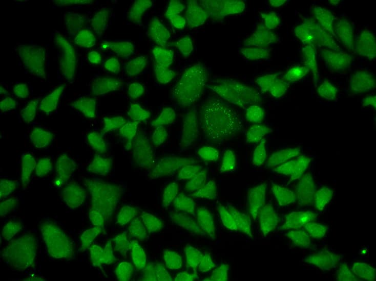 Polyclonal Rabbit anti-Human ALDH2 Antibody (IHC, IF, WB)