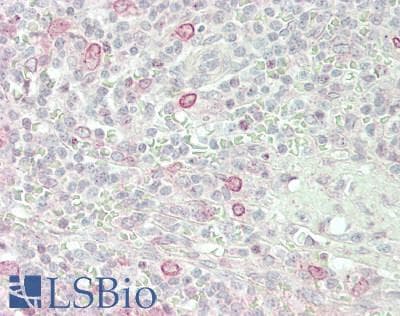 IHC-plus™ Polyclonal Rabbit anti-Human TOR1AIP1 / LAP1 Antibody (400-480 aa, Internal, IHC, WB)