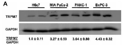 Monoclonal Mouse anti-Human GAPDH Antibody (clone OTI2D9, WB)