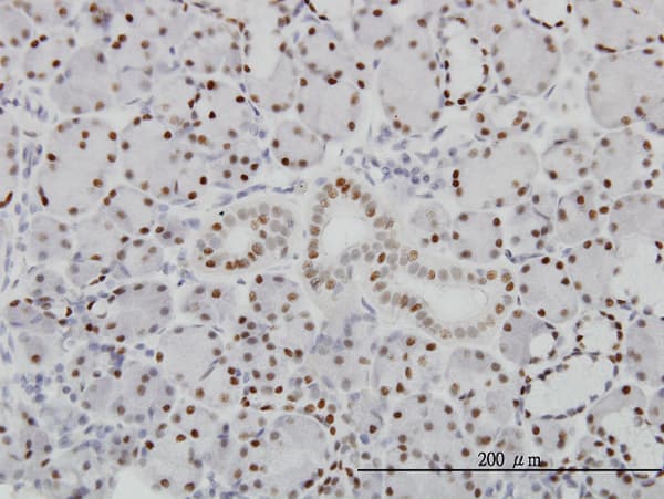 Monoclonal Mouse anti-Human PBX1 Antibody (clone 4A2, IHC, IF, WB)