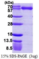 Human KARS Protein (Recombinant His)