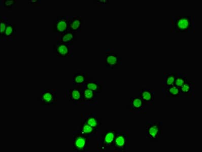 DNTT / TdT Antibody