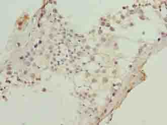 KRT80 / Keratin 80 Antibody