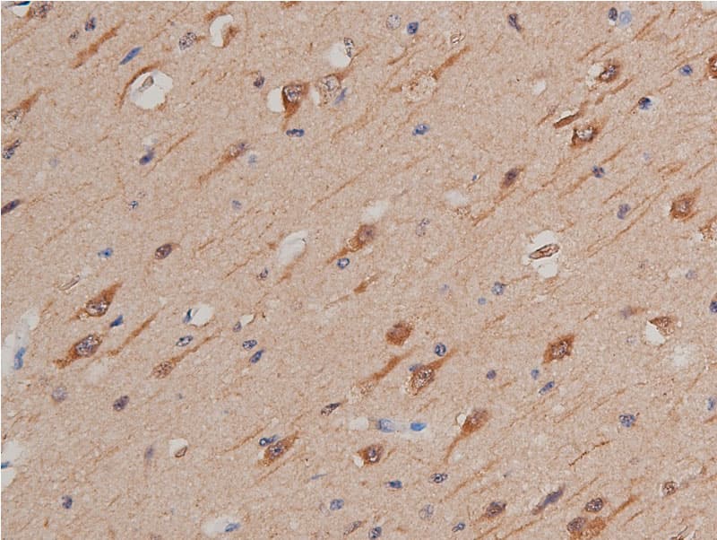 Polyclonal Rabbit anti-Human GSK3A / GSK3 Alpha Antibody (IHC, WB)