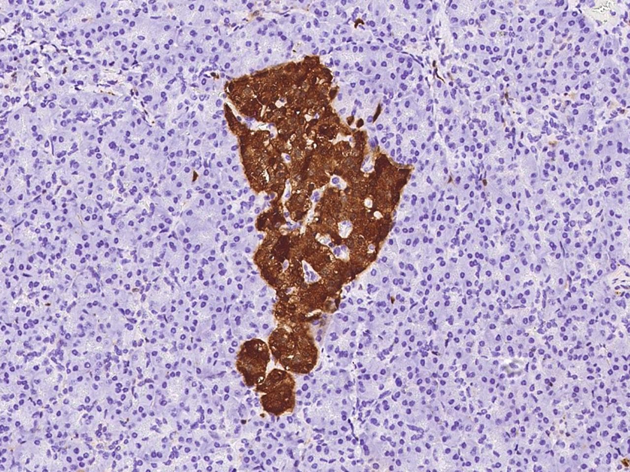 Monoclonal Mouse anti-Human ENO2 / NSE Antibody (clone 14, Preservative Free, IHC, WB)