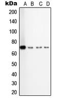 Polyclonal Rabbit anti-Human TGFBR2 Antibody (Internal, WB)