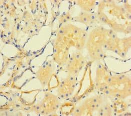 FAM167A Antibody