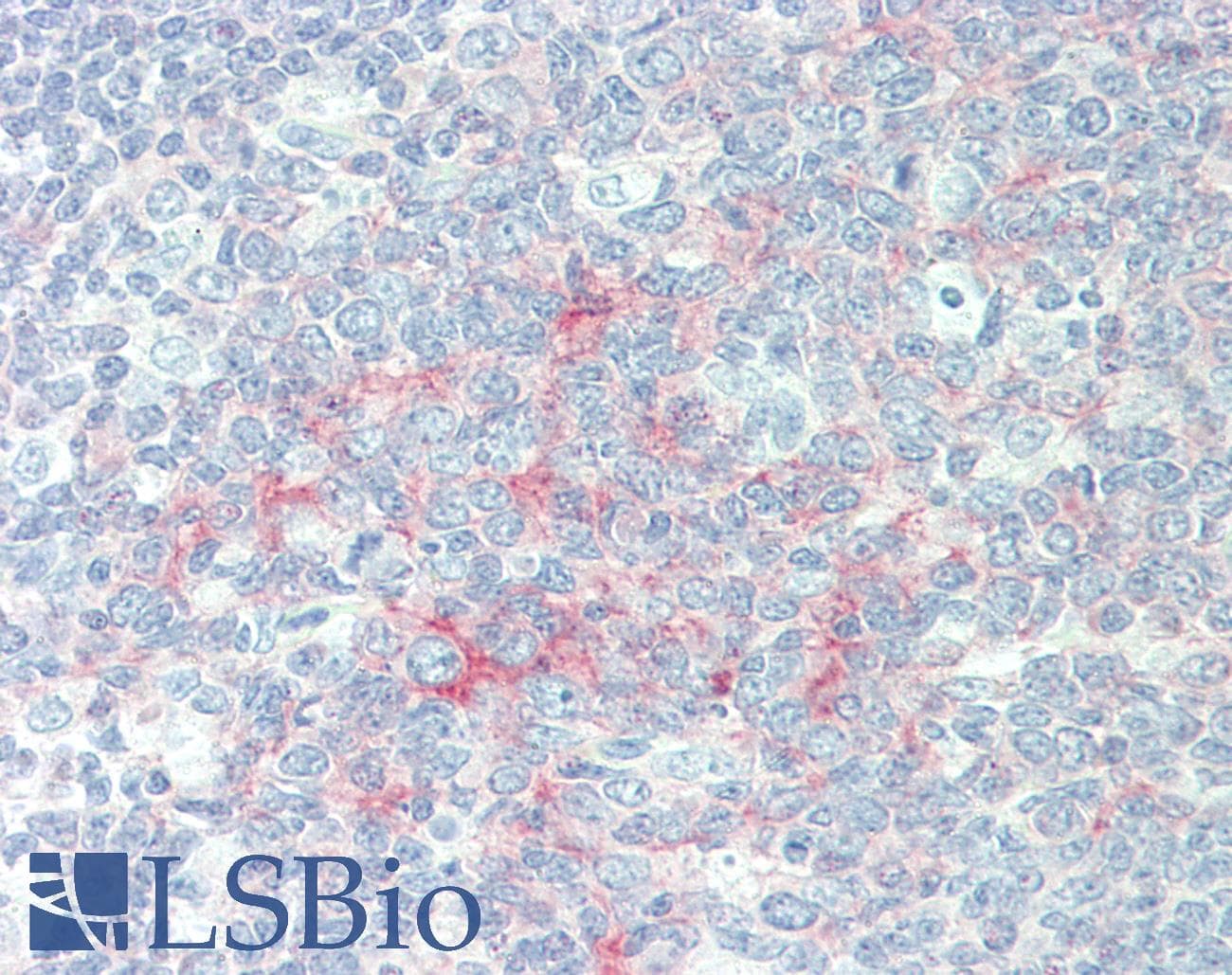 IHC-plus™ Polyclonal Rabbit anti-Human TAOK3 / JIK Antibody (aa850-C-term, IHC, WB)