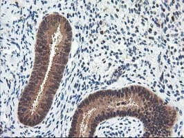 NUDT18 Antibody (clone OTI5F9)