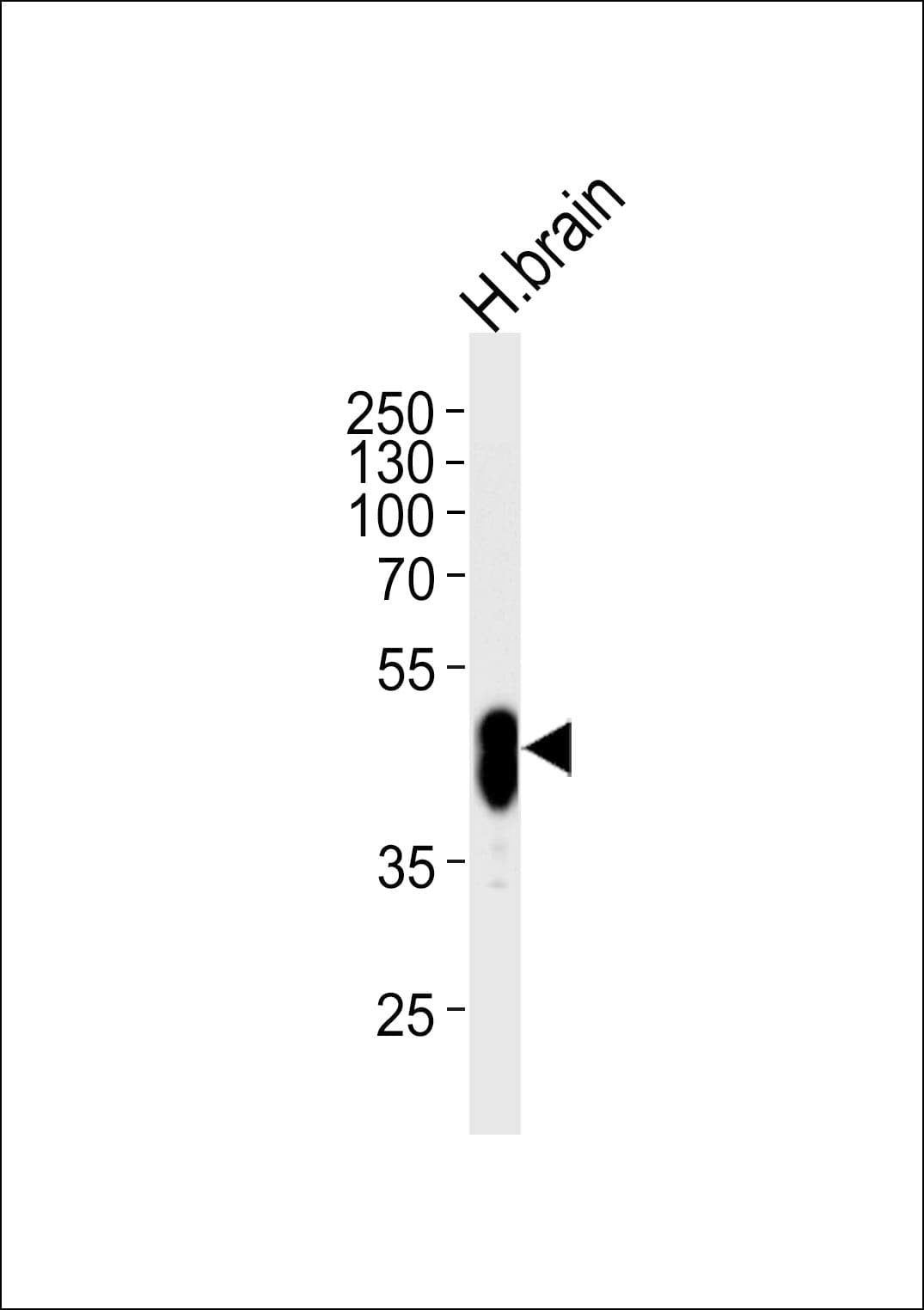 IHC-plus™ Polyclonal Rabbit anti-Human PFTK1 / CDK14 Antibody (aa67-96, IHC, WB)