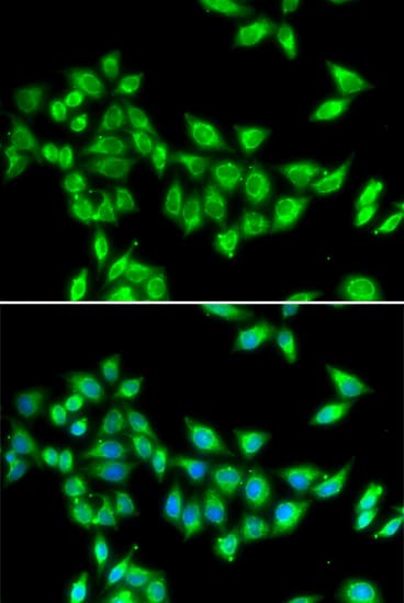 Polyclonal Rabbit anti-Human KIF3A Antibody (IHC, IF, WB)