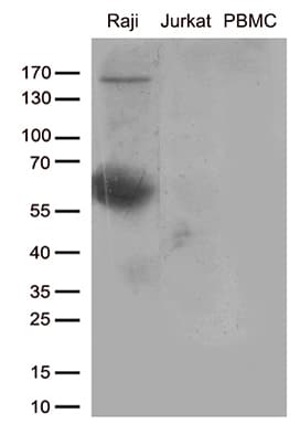 Monoclonal Mouse anti-Human CD80 Antibody (clone OTI1G9, WB)