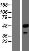 Human CTSA / Cathepsin A Protein (Over-Expression Lysate Myc-DDK (Flag))