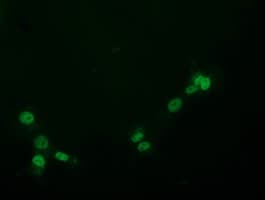PYCRL Antibody (clone OTI3B9)