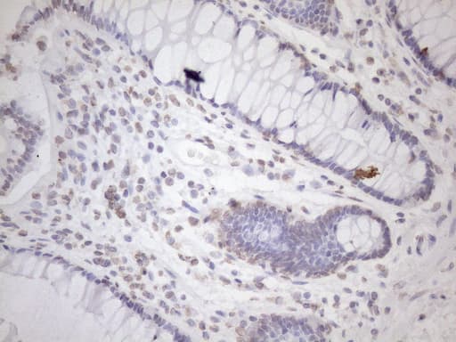 EXOSC1 / CSL4 Antibody (clone OTI4C7)