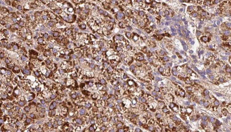 KCNE3 Antibody