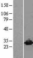 UCHL3 Protein (Over-Expression Lysate Myc-DDK (Flag))