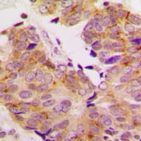 Polyclonal Rabbit anti-Human RPS6KB1 / P70S6K / S6K Antibody (C-Terminus, IHC, WB)