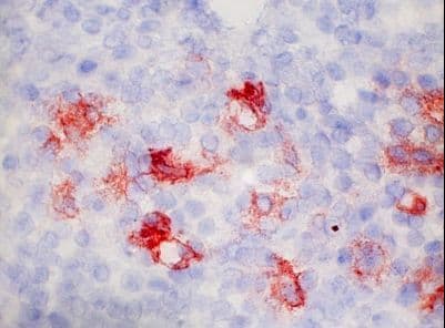 ITGAM / CD11b Antibody (clone X-5)