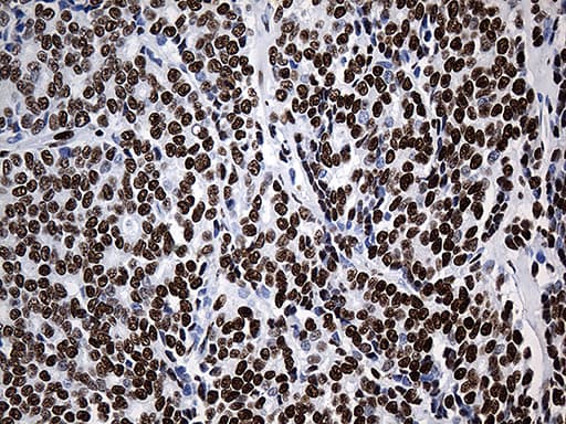 HNRNPH1 / hnRNP H Antibody (clone OTI5D11)