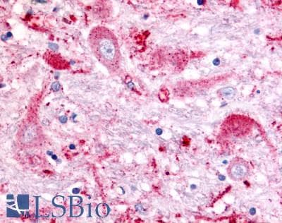 PathPlus™ GPR151 Antibody (C-Terminus)