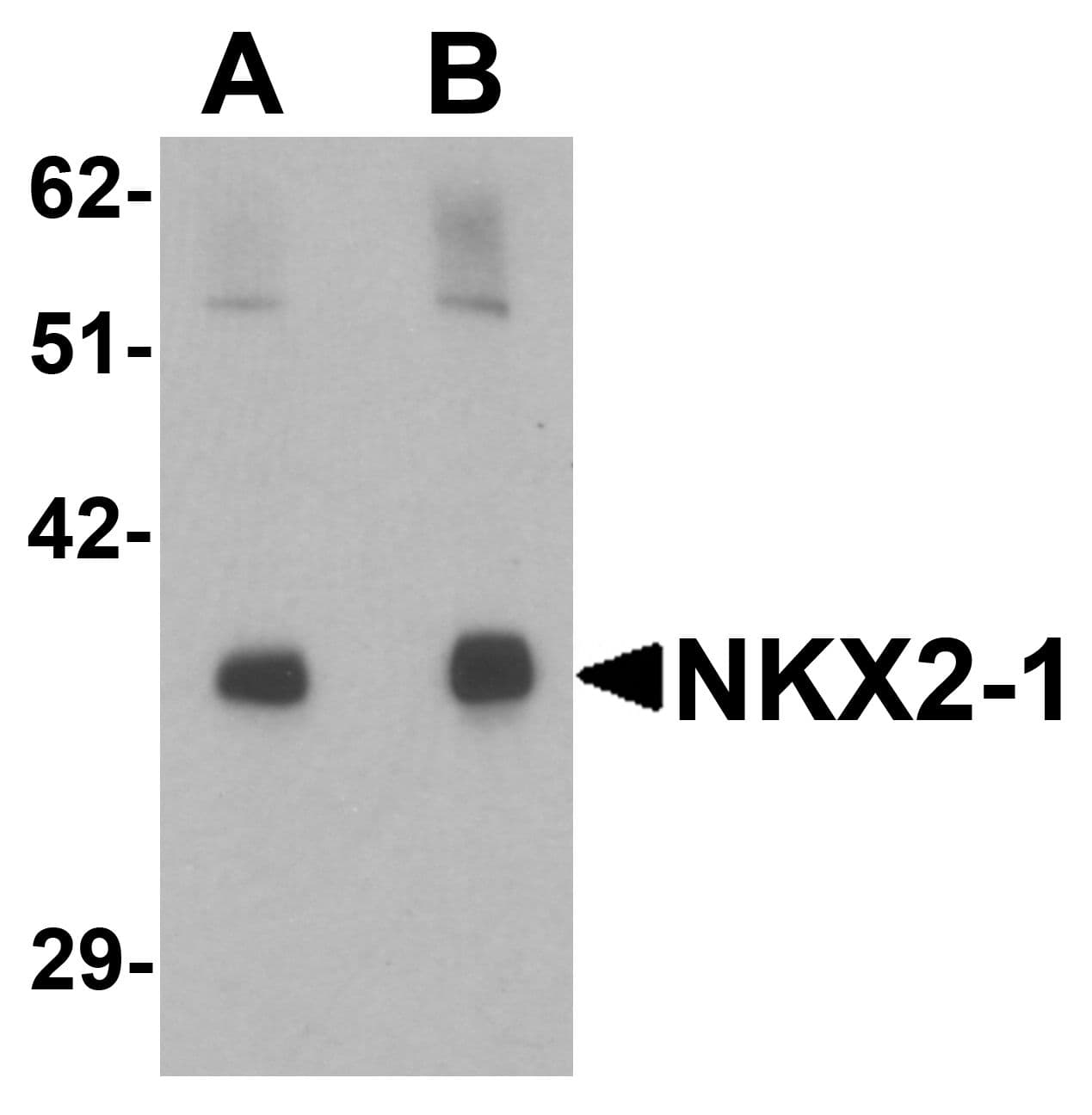 Polyclonal Rabbit anti-Human NKX2-1 / Thyroid-Specific TF Antibody (IHC, IF, WB)