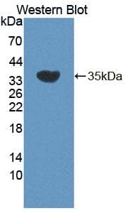 ESRRB / ERR Beta Antibody (Biotin)