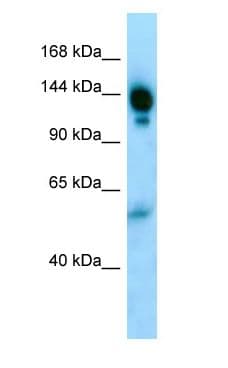 Polyclonal Rabbit anti-Human A2M / Alpha-2-Macroglobulin Antibody (aa259-308, WB)