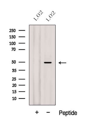 GCD / GCDH Antibody