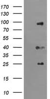 Monoclonal Mouse anti-Human USP16 Antibody (clone OTI1B4, WB)