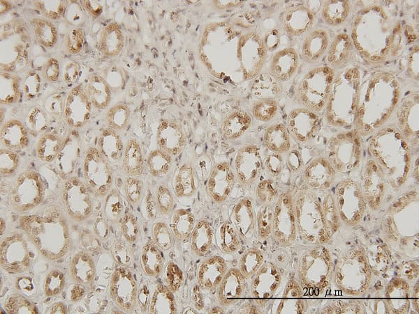 Monoclonal Mouse anti-Human EXOSC3 Antibody (clone 5C3, IHC, WB)