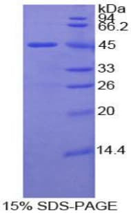 Mouse LAMP2 / CD107b Protein (Recombinant His-GST)