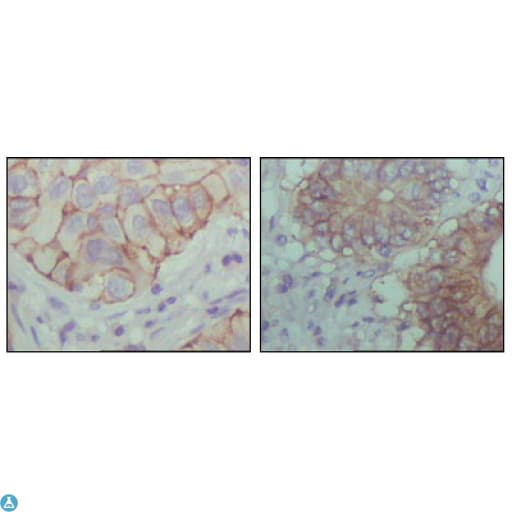 EPHB1 / EPH Receptor B1 Antibody