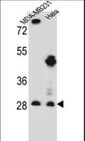 Polyclonal Rabbit anti-Human EIF4H Antibody (aa127-156, IHC, WB)