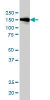 Monoclonal Mouse anti-Human INPPL1 / SHIP2 Antibody (clone 3E6, WB)