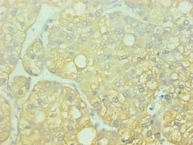 Monoclonal Mouse anti-Human AHSG / Fetuin A Antibody (clone 4A1B5, IHC)