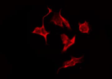 Polyclonal Rabbit anti-Human OR4A4 + OR4A47 Antibody (IF, WB)