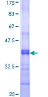 Human AMPD2 Protein (Recombinant GST, N-terminus)