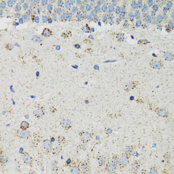 RTN4R Antibody