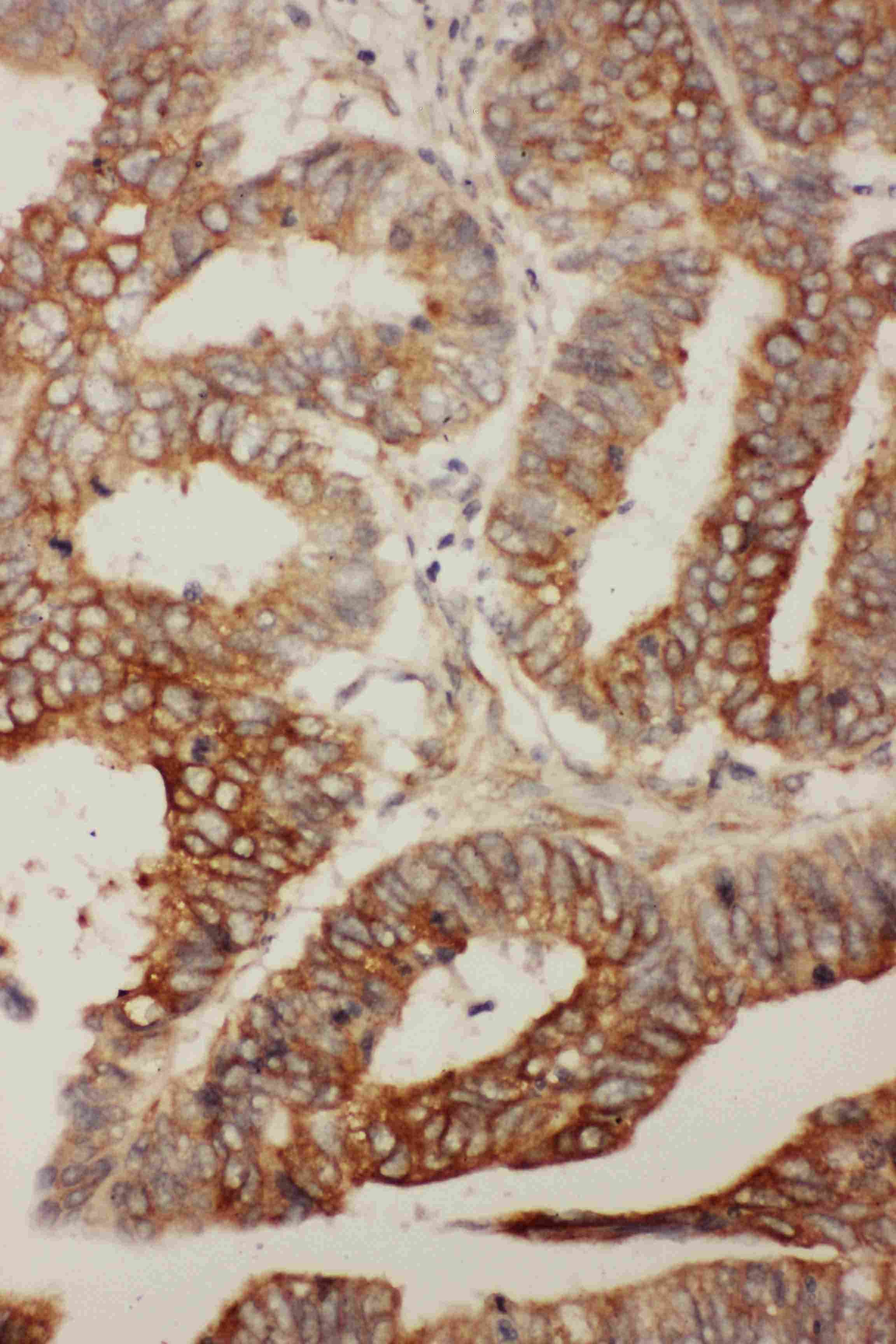 BCL2L2 / Bcl-w Antibody (C-Terminus)