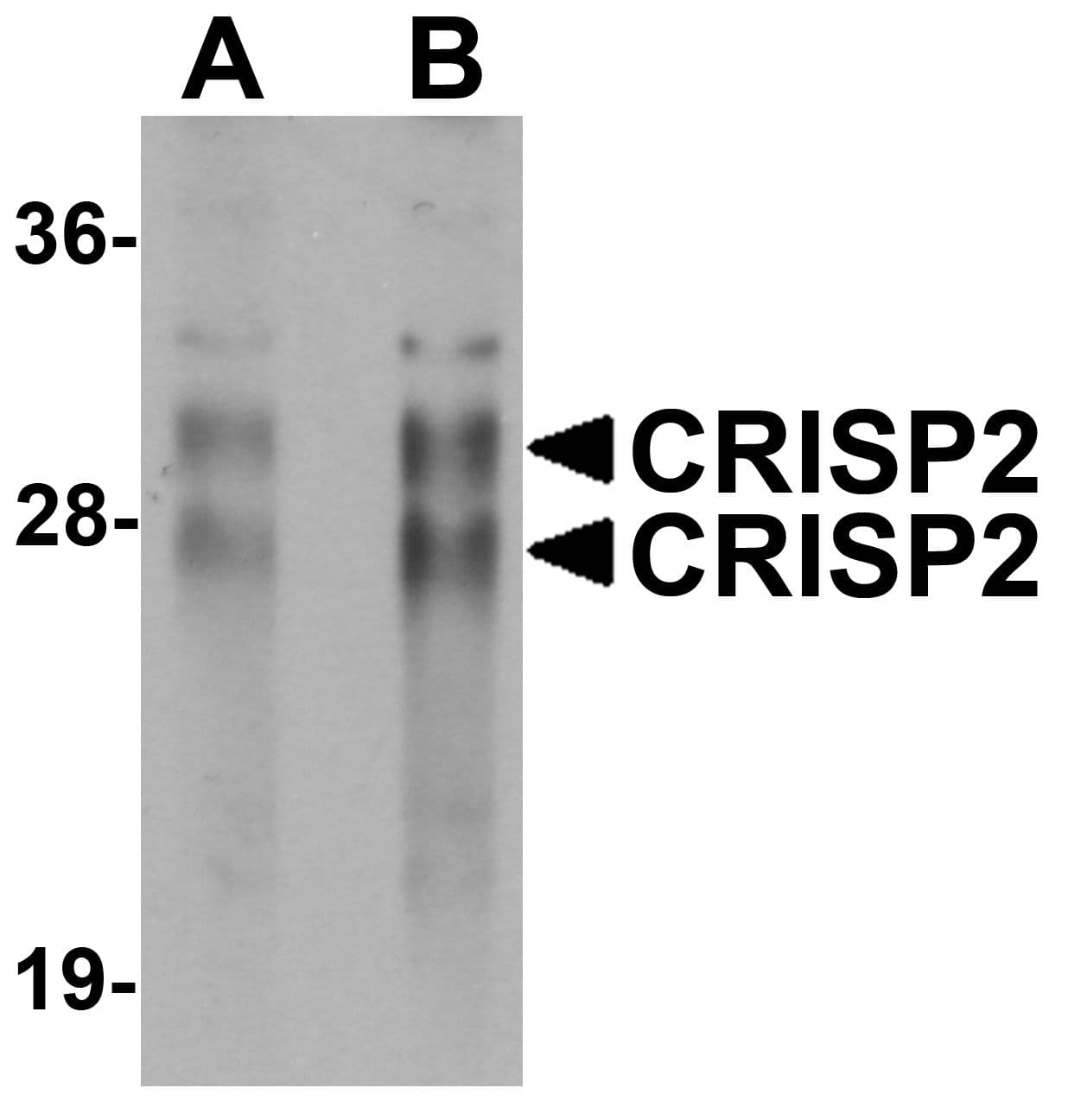 IHC-plus™ CRISP2 / TSP1 Antibody