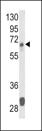 GLS / Glutaminase Antibody (aa516-545)